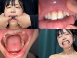 よだれダラダラすずちゃんの口内観察