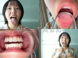 【個人撮影】加護まりの舌ブラシで「汚舌苔」採取